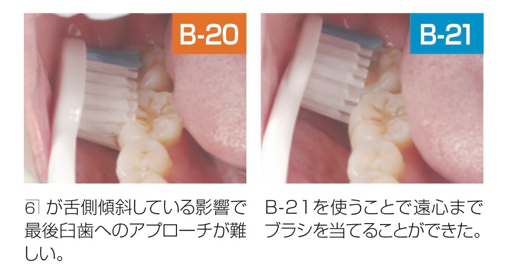 旧型B-20・新型B-21のヘッドの薄さ比較